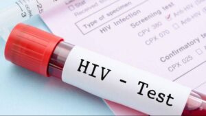 dunyada 408 milyon kisi hiv ile yasiyor turkiyede artis suruyor HNwAXNP3.jpg